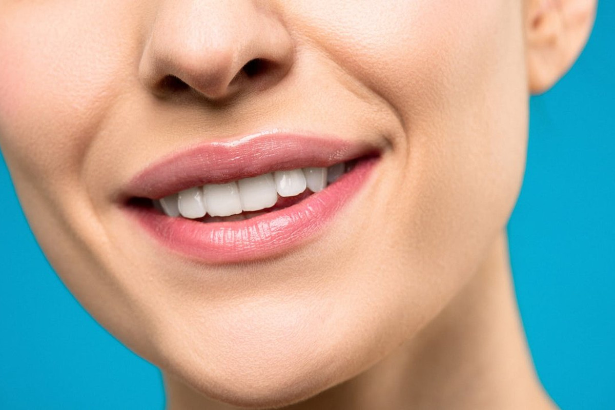 Clareamento dental — sorriso com dentes mais brancos
