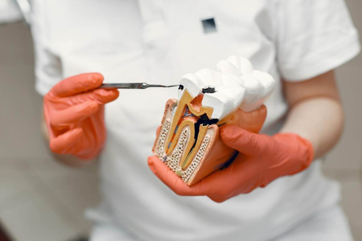 Tratamento de canal — modelo anatômico mostrando estrutura radicular do dente